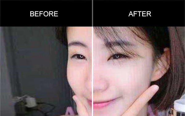 Anmyna Make Up Cream, Before and After, Testimonials, Anmyna Online, Great Results, Skincare, RESULTS YOU’LL LOVE, our customers, happy customer, before after result